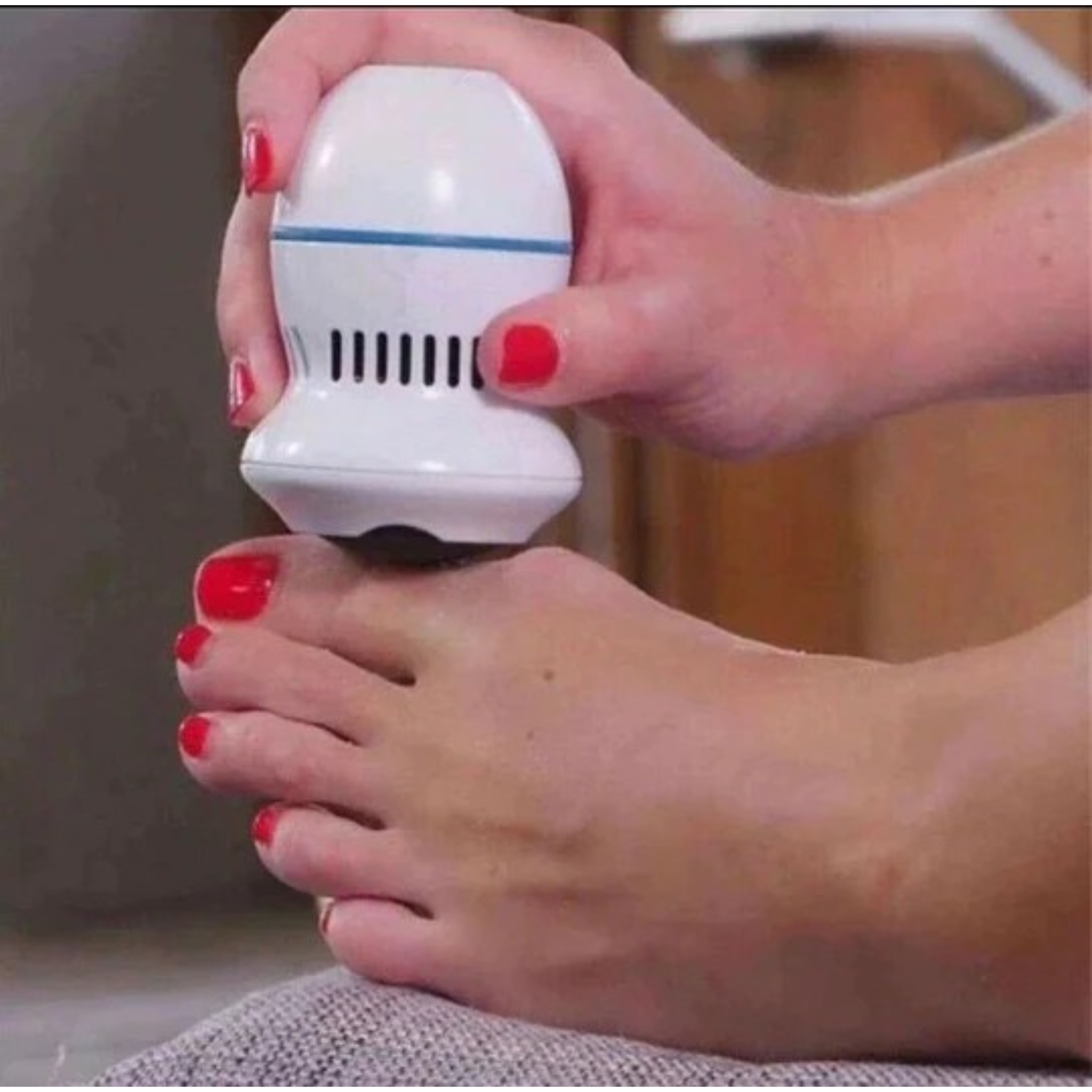 Electric Callus Remover – مزيل الجلد الميت الكهربائي